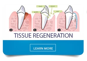 learn more about tissue regeneration