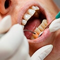 Bone Loss From Gum Disease Or Periodontitis
