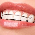 Teeth Alignment With Removable & Permanent Retainers