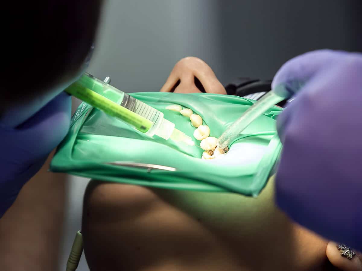 Man Recieving Root Canal Therapy In Washington Heights, NY
