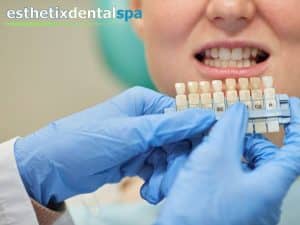 Why Dental Implants are the Best Option for Replacing Missing Teeth