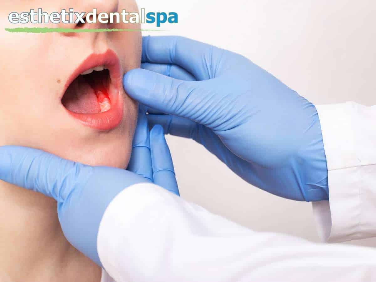 Dentist Treating Periodontitis in NY