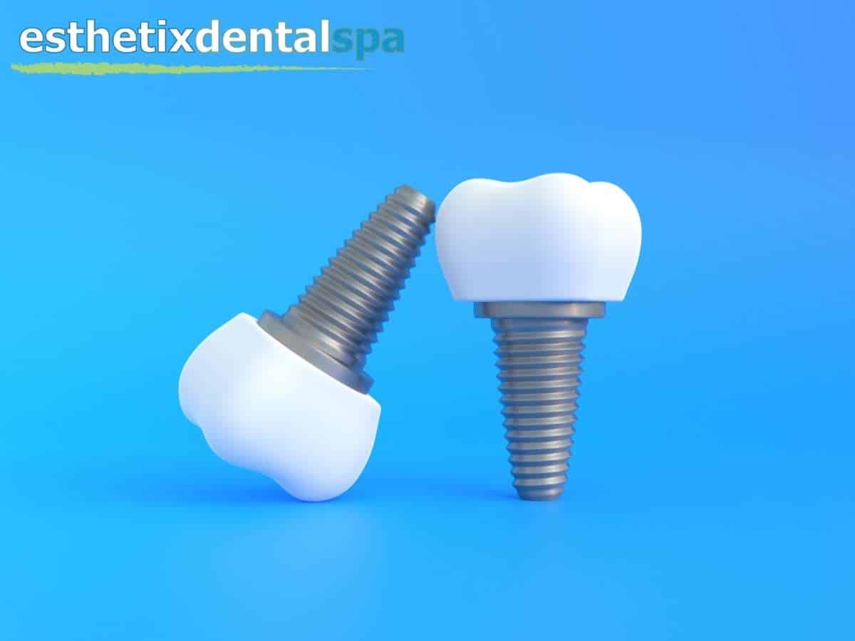 Dental Implants In Washington Heights