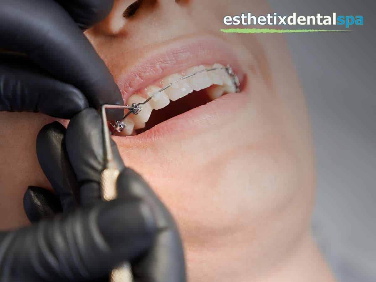 Washington Heights putting braces on a patient 
