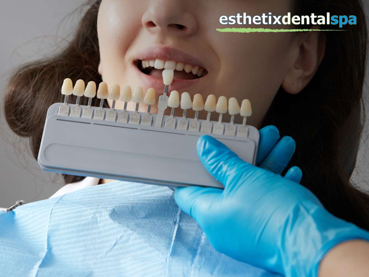 Washington Heights dentist Dental Implant 
