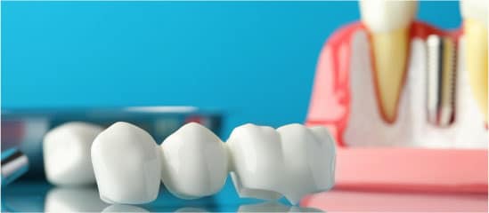 Get Dental Bridges Of The Highest Quality At Our Dental Office In Washington Heights