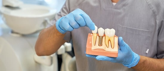 Expert Dentists Offering All On 4 Dental Implants For Bronx Residents