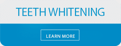 teeth-whiteing-2