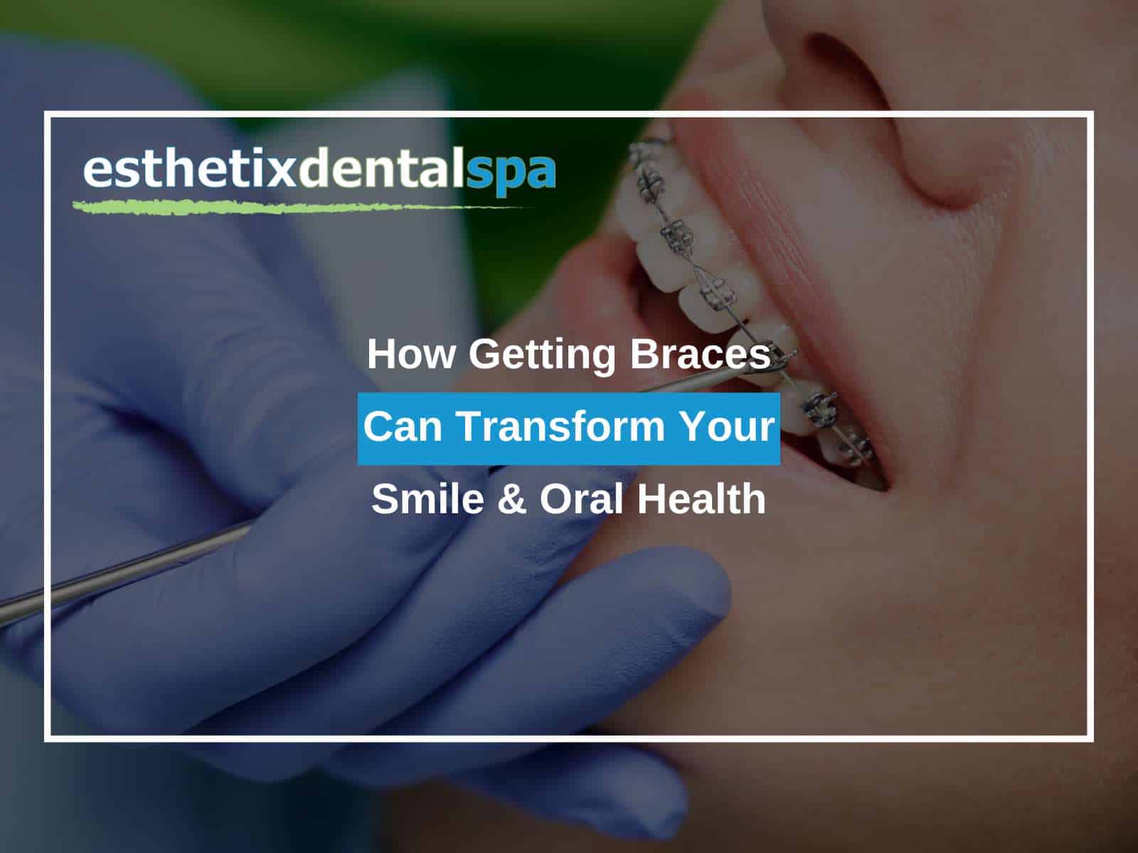 How Getting Braces Can Transform Your Smile & Oral Health