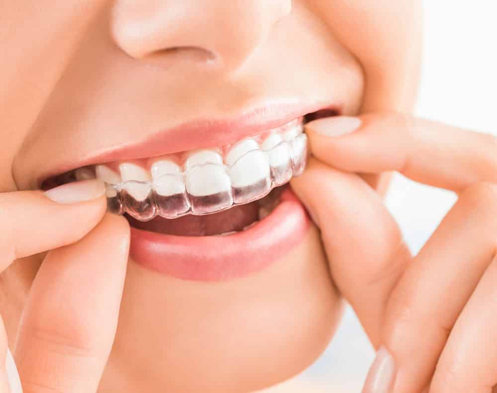 Check And Select The Color Of The Teeth In The Dentists Chair. D