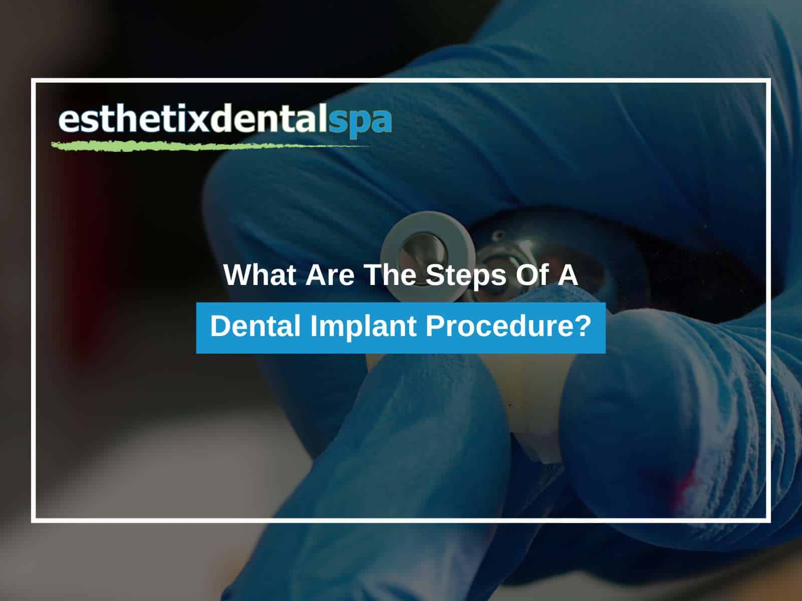 What Are The Steps Of A Dental Implant Procedure?