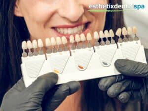 Dentist matching tooth shade for a dental implant procedure