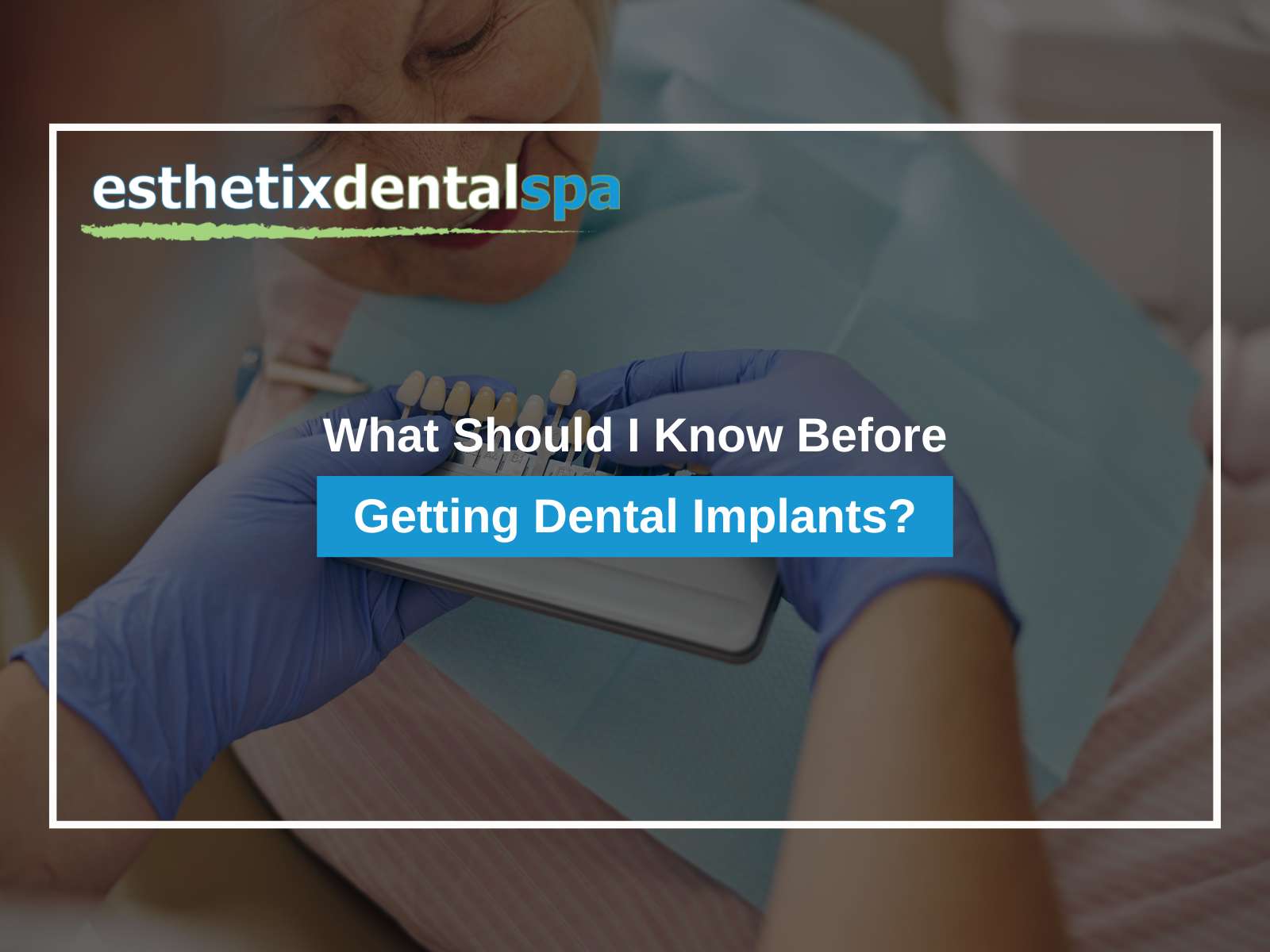 What Should I Know Before Getting Dental Implants?