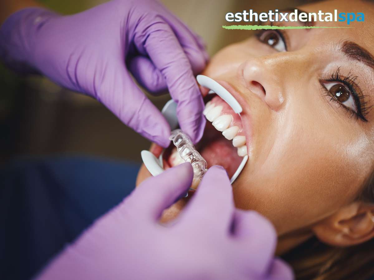Dentist fitting Invisalign aligners for a female patient