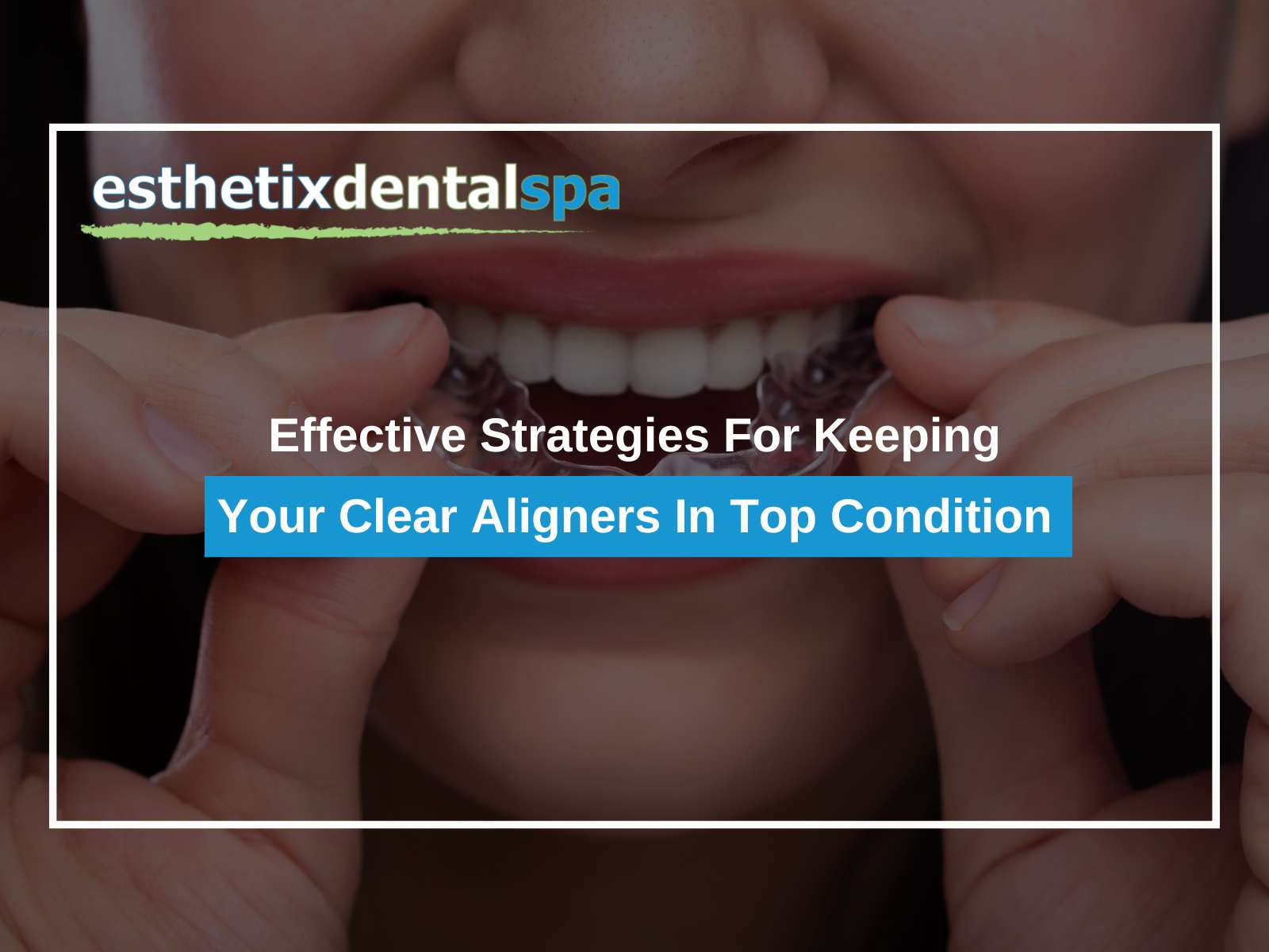 Effective Strategies For Keeping Your Clear Aligners In Top Condition