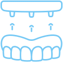 Durable implant-supported dentures providing a natural look and feel