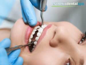 Patient undergoing Root Canal Therapy at Esthetix Dental Spa