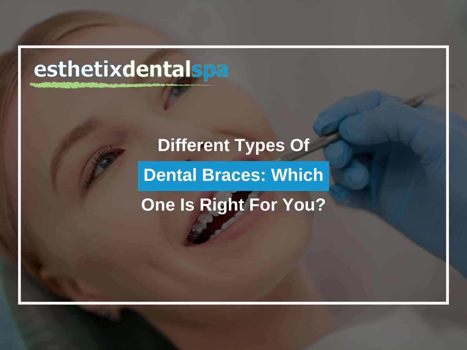 Different Types Of Dental Braces: Which One Is Right For You?