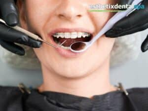 Dentist performing a routine checkup on dental braces at Esthetix Dental Spa.